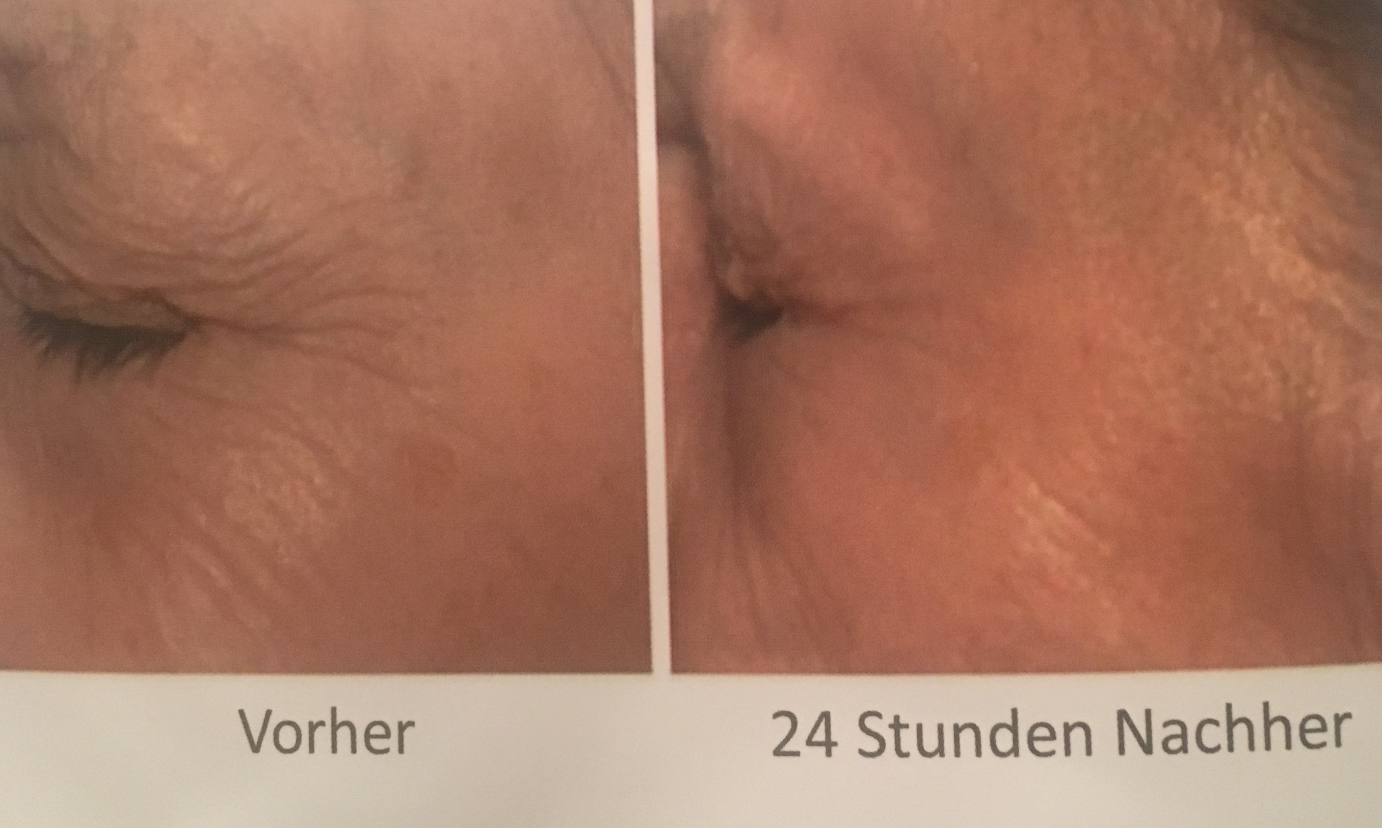 Schonheitskultur Hannover Galerie Luise Microneedling Praxis Fur Kosmetische Wirkstoffbehandlungen Professionelle Fusspflege